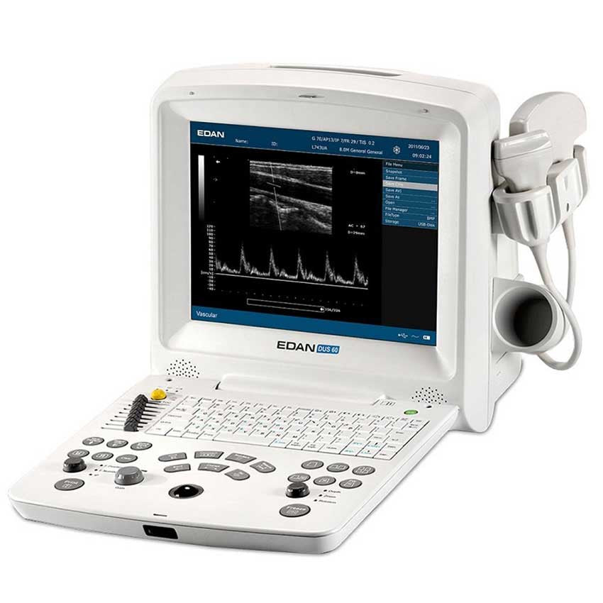 Booth Medical - Edan DUS 60 Digital Ultrasonic Diagnostic Imaging System